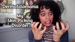 I Have Dermatillomania  My Skin Picking Disorder [upl. by Quint469]