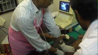 intussusception by Dr K M Abul Hasan [upl. by Waiter328]