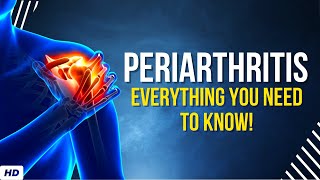 Periarthritis Everything You Need to Know [upl. by Maighdlin]