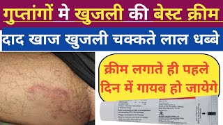 खाज खुजली की बेस्ट क्रीम  khaj khujli ka ilaj medicine  Dermikem oc cream  fungul infection cream [upl. by Lombardy]