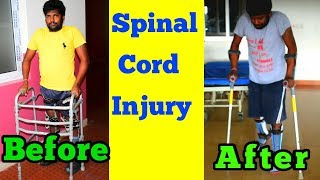 spinal cord injury paraplegic before and after improvement [upl. by Brianne]