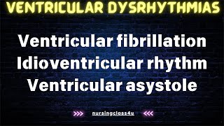 Ventricular fibrillation  Idioventricular Rhythm  Ventricular Asystole [upl. by Puna]