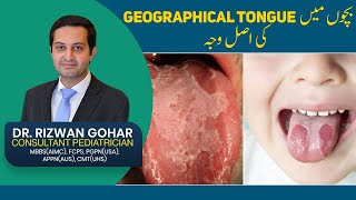 Treatment of Geographic Tongue👅😛 geographic tongue treatment [upl. by Eidaj973]