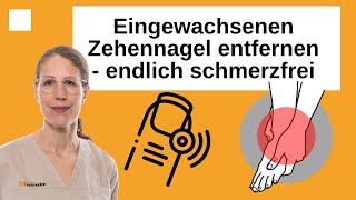 Eingewachsenen Zehennagel entfernen  Schmerzen beim Gehen loswerden [upl. by Einhoj]