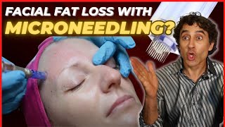 WILL MICRONEEDLING CAUSE YOUR FACIAL FAT LOSS and DAMAGE YOUR SKIN [upl. by Ainniz]