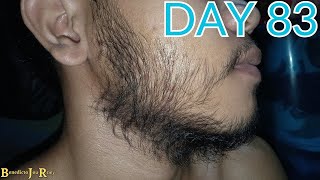 DAY 83  KIRKLAND MINOXIDIL BEARD JOURNEY [upl. by Akinoj]