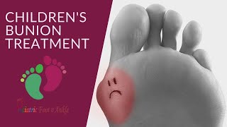 Bunion Treatment for Children [upl. by Morton]