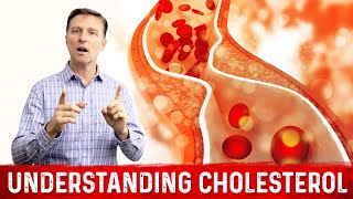 How to Read and Understand Your Cholesterol Levels [upl. by Silberman675]