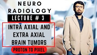 Difference bw Intraaxial amp Extraaxial Brain Tumors  Intra axial Brain Tumor  Extra axial Tumor [upl. by Inilam]