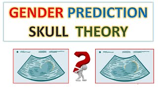 SKULL THEORY FOR GENDER PREDICTION  GENDER PREDICTION  BOY OR GIRL  BLUE OR PINK [upl. by Heurlin]