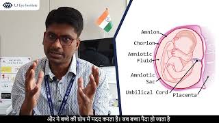 What is Amniotic Membrane Grafting Surgery Explained in Hindi by Cornea Specialist Dr Vikas Mittal [upl. by Anawahs]