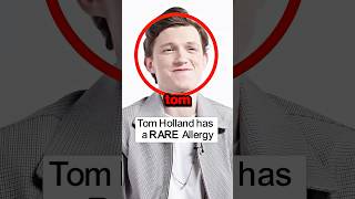 Tom Holland’s RARE Allergy 😦 tomholland spiderman [upl. by Meill502]