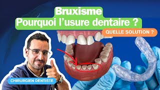 Bruxisme dentaire  comment identifier et traiter efficacement [upl. by Eedoj844]