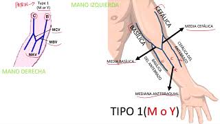 VENAS TÍPICAS PARA IV Y EXTRACCIÓN DE SANGRE  FLEBOTOMIA  Pura Ciencia [upl. by Imekawulo554]