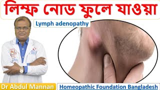 লিম্ফ এডিনোপ্যাথি। লিম্ফ নোড ফুলে যাওয়া । Lymph adenopathy ।হোমিওপ্যাথিক চিকিৎসা । Dr Abdul Mannan [upl. by Rovert]