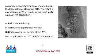 Venogram in a Neonate During PDA Closure  NICU [upl. by Tlok385]