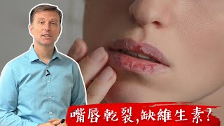 嘴唇乾裂缺什麼維生素 自然療法 柏格醫生 Dr Berg [upl. by Polash]