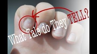 A Study in Fingernails Day to Day Deductions Docuvlog 1 [upl. by Aceber]