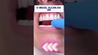 preço acessível para implantes dentários [upl. by Matejka995]