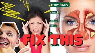 New Faster Lymphatic drainage for Headache amp sinusitis drainage tutorial [upl. by Jonie]