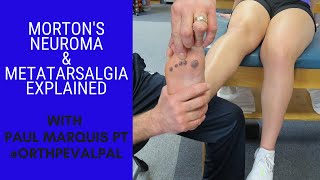 Mortons Neuroma and Metatarsalgia Whats the Difference [upl. by Mukund]