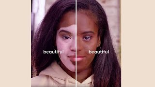 Dermablend Reflections – Foundation for Vitiligo [upl. by Franciskus]