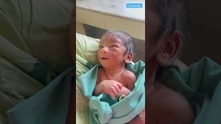 Abnormal Newborn Baby video medical viralvideo [upl. by Persson530]