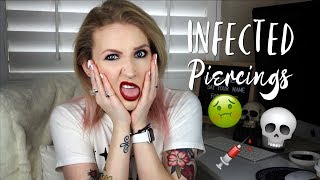 IS MY PIERCING INFECTED  Signs Of An Infected Piercing [upl. by Mandi]