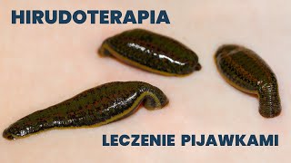 Hirudoterapia czyli lecznicza moc pijawki [upl. by Aennil5]