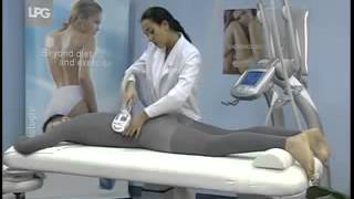 LPG Endermologie treatment demo  Salon House  London [upl. by Ferneau]