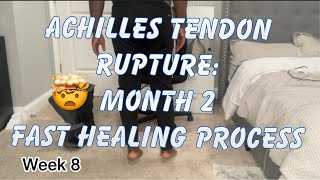 Achilles Tendon Rupture  Month 2  How I made my tendon heal fast [upl. by Aday]