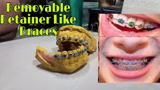 Retainer Like braces sa Pustiso Pustiso with braces na may Ngipin Dental Braces in The Philippines [upl. by Dowell]