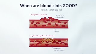 Anticoagulants [upl. by Adallard]