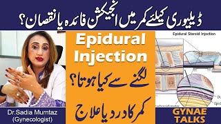 Epidural Injection In Labor  Delivery without pain Urdu Hindi  Kamar Men Injection [upl. by Chuipek]