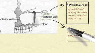 Anatomy of maxillary sinus [upl. by Anderson]