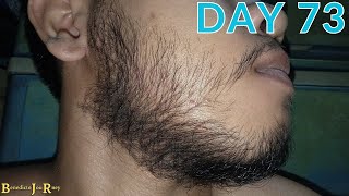 DAY 73  KIRKLAND MINOXIDIL BEARD JOURNEY [upl. by Eerhs]