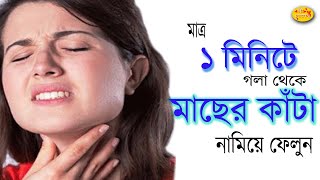 মাত্র ১ মিনিটে গলায় আটকে থাকা মাছের কাঁটা দূর করুন ঘরোয়া উপায়ে।Bangla Health Tips।Shree choroneshu [upl. by Abigale]