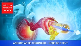 Angioplastie coronaire  pose de stent [upl. by Dorsey463]