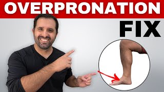 4 Exercises To Correct Overpronation In Runners To Prevent Injury [upl. by Kiernan308]