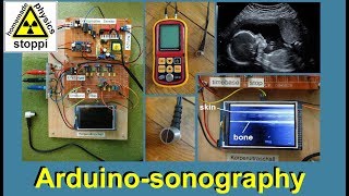 ultrasonic body sonography with arduino  part 2 [upl. by Irik]