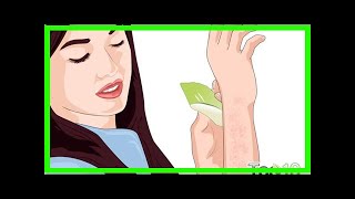 How to Get Rid of Bumps on Arms [upl. by Madaih]