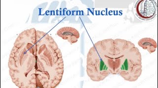 Brain Anatomy 13 Basal Ganglia 2 Lentiform NucleusInternal CapsuleClaustrum [upl. by Jeraldine]