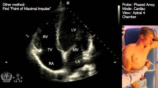 Apical 4 Chamber View on Transthoracic Echocardiography Cardiac Ultrasound [upl. by Pelage]