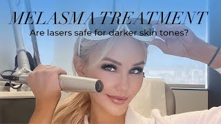 Are lasers safe to use for MELASMA Best way to treat melasma  Melasma treatment at home [upl. by Azmah162]