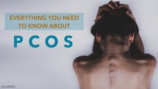 Everything You Need To Know About PCOS  Causes Symptoms Treatments [upl. by Ecinom336]