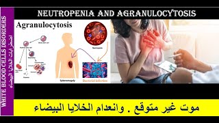 Lecture 23 Neutropenia and Agranulocytosis [upl. by Odnalor]