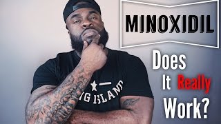 Does Minoxidil Really Work  Minoxidil Beard Growth [upl. by Byron752]