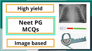 Neet Pg MCQ Pediatric subject high yield mbbs neetpgpreperation pediaticlectureformedicalstudent [upl. by Billie821]