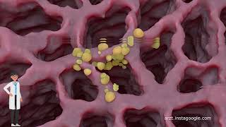 Unterschiede in den Symptomen zwischen Lungenkrebs und COPD [upl. by Parhe]