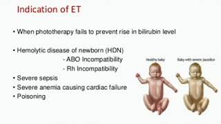 case 310 the most common cause of exchange transfusion alloimmune hemolytic anaemia RH incompatib [upl. by Panchito707]